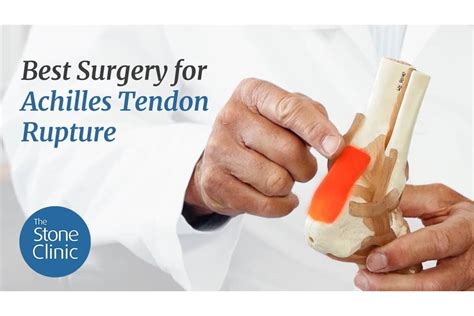 Best Surgery for Achilles Tendon Rupture (Video Blog)