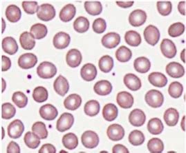 Diameter of Human Red Blood Cell