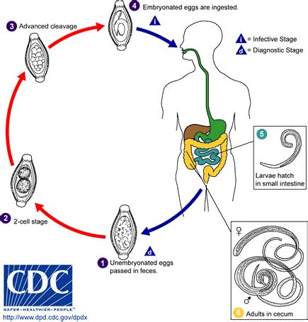 Whipworm infection pathophysiology - wikidoc