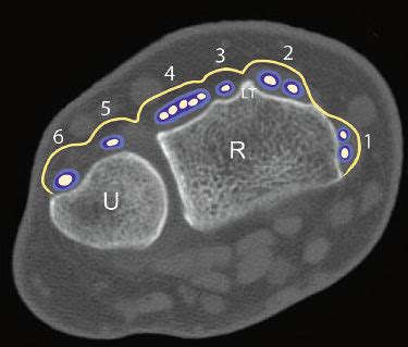 Imaging of the Wrist | Radiology Key