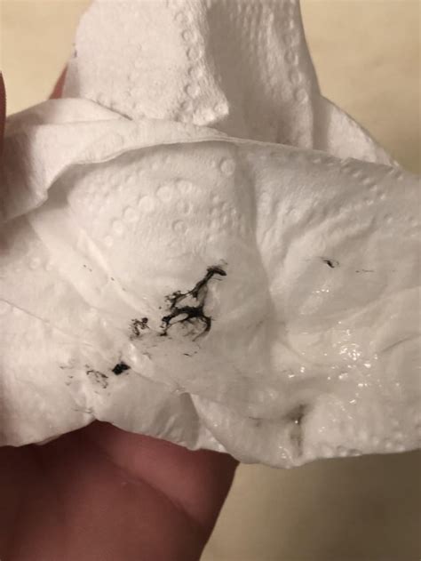 15, coughing up and finding black specks in mucus : r/medical