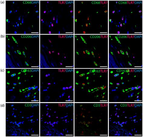 Cells | Free Full-Text | TLR7 Expression Is Associated with M2 ...