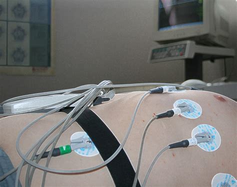 Ecg Electrodes Attached To Torso Free Stock Photo - Public Domain Pictures