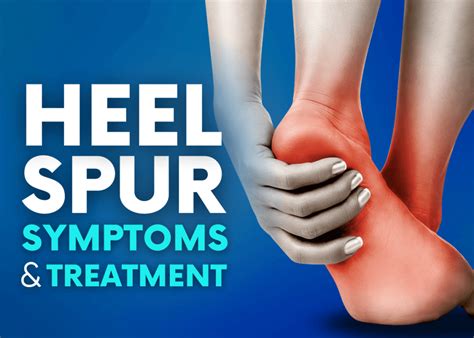 What is Heel Spur: Symptoms, Diagnosis and Treatment - Turan&Turan