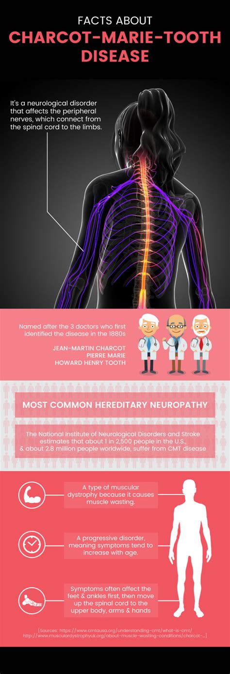 Charcot-Marie-Tooth Disease and Symptoms - MKExpress.net