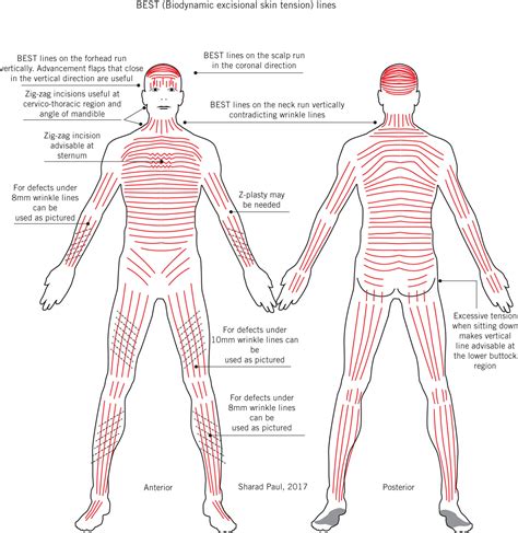 Biodynamic excisional skin tension lines for surgical excisions ...