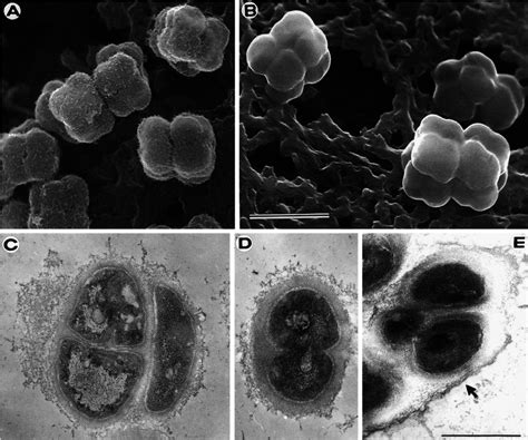 Electron microscopic study of Kytococcus sedentarius TR-2. (A) Scanning... | Download Scientific ...