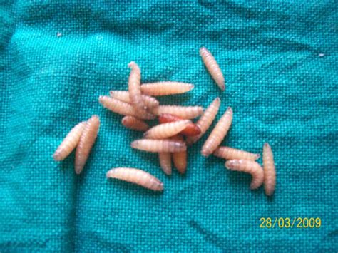 Maggots In Human Nose