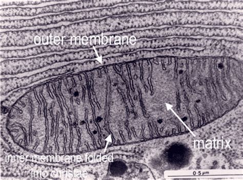 Mitochondria Electron Micrograph Labelled