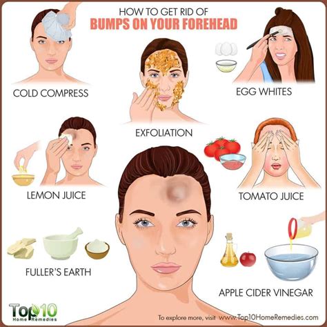 How to Get Rid of Bumps on Forehead | Top 10 Home Remedies # ...