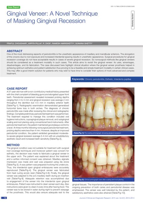 (PDF) Gingival Veneer: A Novel Technique of Masking Gingival Recession