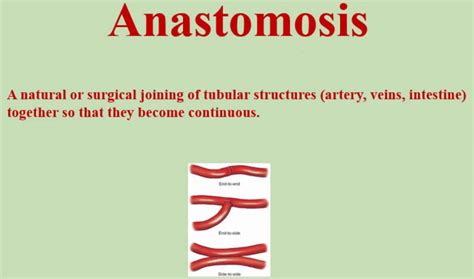 Anastomosis surgery, vascular anastomosis and bowel anastomosis