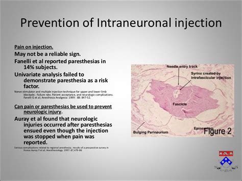 Complications of Regional Anesthesia