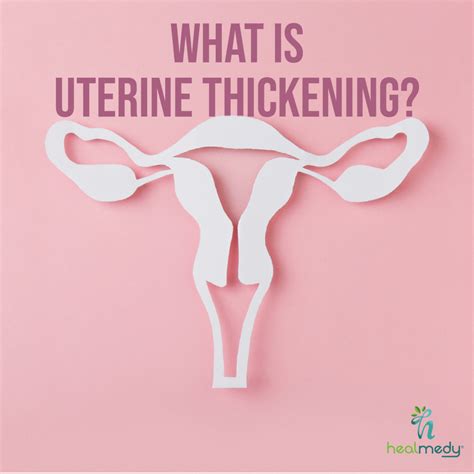 What is Uterine Thickening (Endometrial Hyperplasia)? - HEALTCARE ...