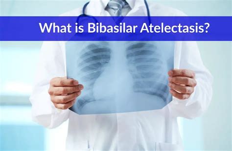 Bibasilar Atelectasis (Definition, Symptoms, Causes, Treatment) - The Healthy Apron