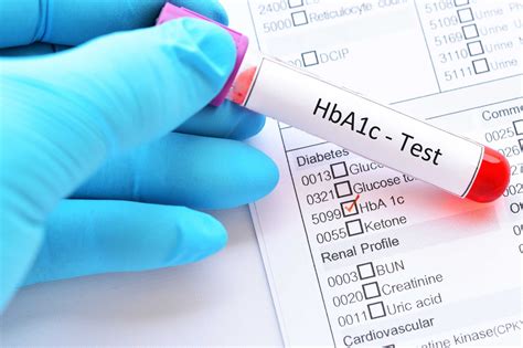 HbA1c Test for Diabetes - Diagnosis, Target HbA1c, Home Tests