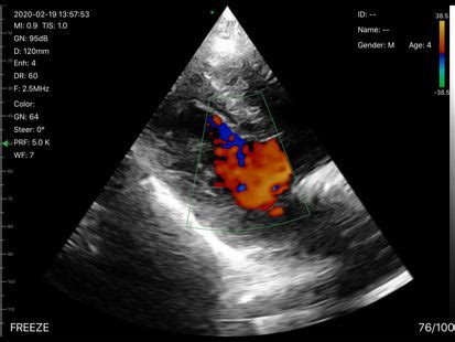 EagleView Dual-Head Wireless Handheld Ultrasound