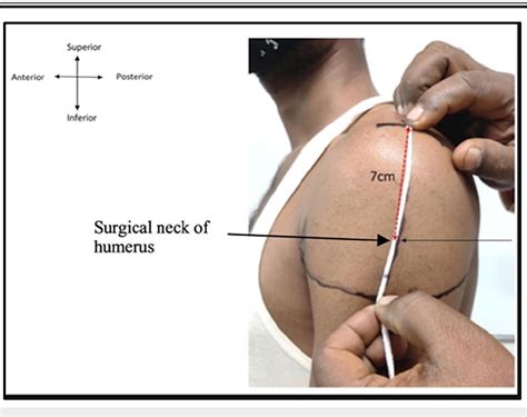 Intramuscular Injection Deltoid