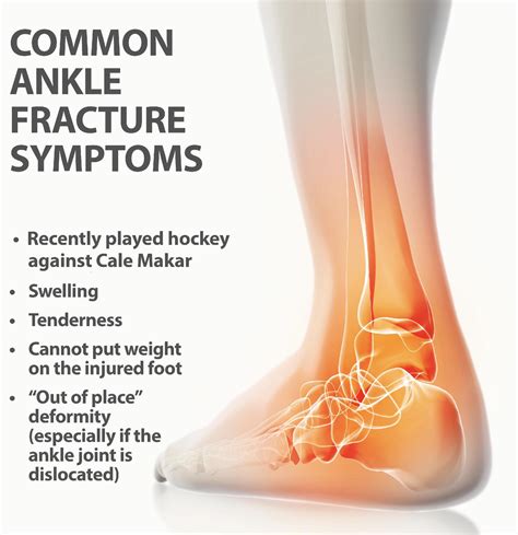 Some important info about common ankle injuries. : r/ColoradoAvalanche