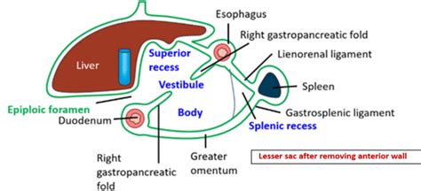 Lesser Sac and Epiploic Foramen , bouundaries and applied aspects , Anatomy QA