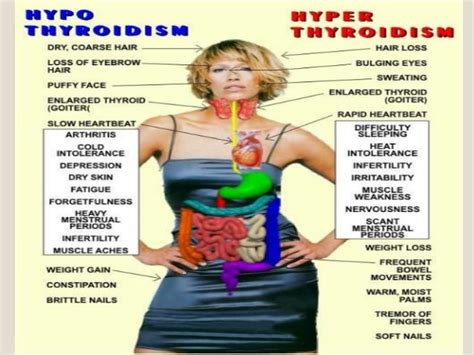 thyroid symptoms in women - DrBeckmann