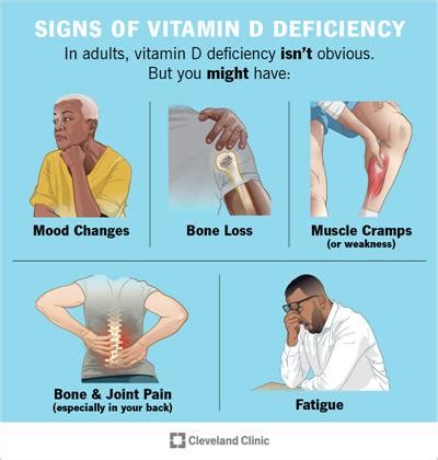 Vitamin D Deficiency: Causes, Symptoms & Treatment