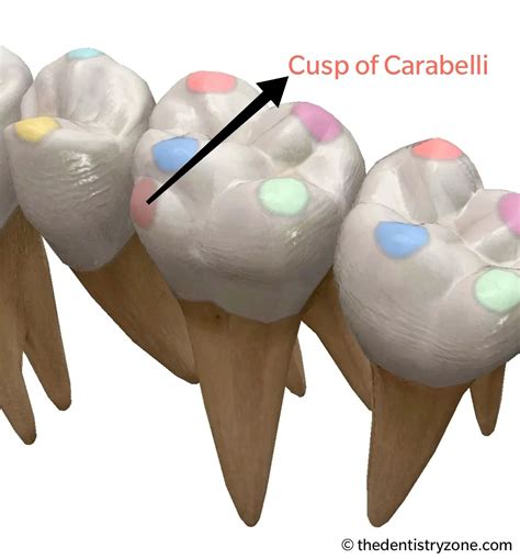 Cusp of Carabelli