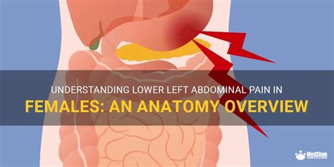 Understanding Lower Left Abdominal Pain In Females: An Anatomy Overview | MedShun