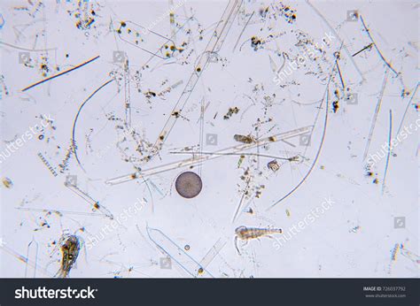 Marine Aquatic Plankton Under Microscope View Stock Photo 726037792 ...