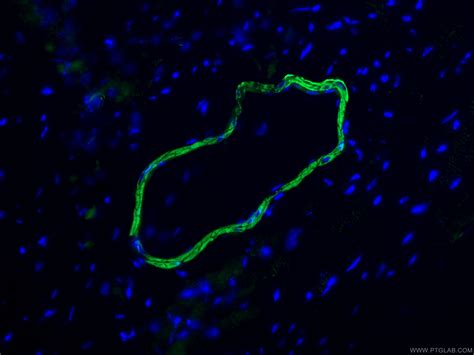 smooth muscle actin specific antibody (80008-1-RR) | Proteintech