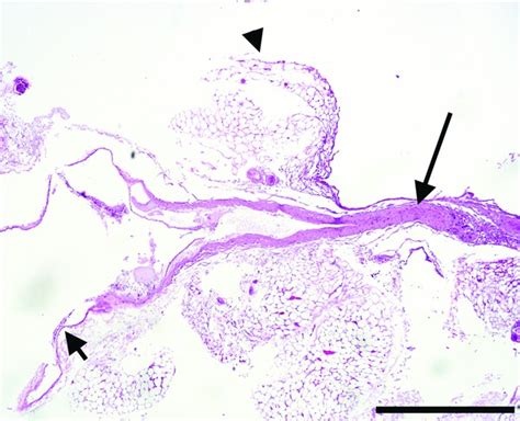 Thoracic duct (TD) and adjacent adipose tissue (H + E, 50×). The ...