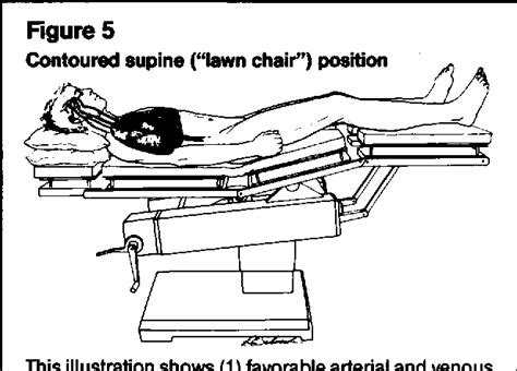 [PDF] The Trendelenburg position: a review of current slants about head down tilt. | Semantic ...