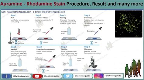 Auramine Stain | Lab Tests Guide