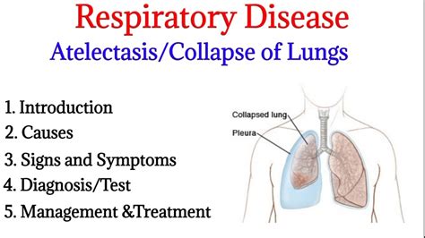 Atelectasis || Introduction, causes, signs &symptoms, diagnosis and ...