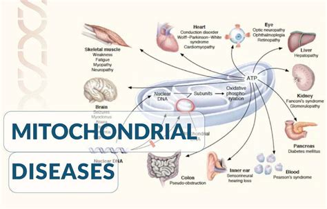 Mitochondrial diseases - Gene Solutions