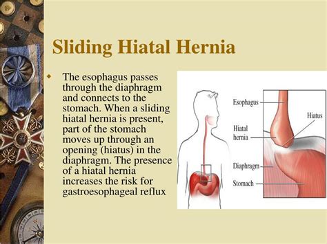 PPT - DIAPHRAGM AND HIATUS HERNIA PowerPoint Presentation, free ...