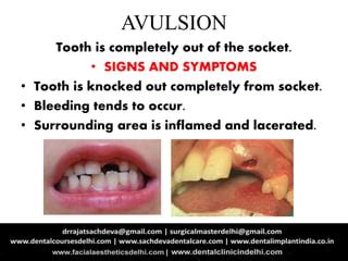 Tooth Injuries| Tooth Trauma| Treatment of Tooth Trauma | PPT