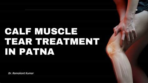 Dr. Ramakant Kumar – Best for Calf Muscle Tear Treatment in Patna