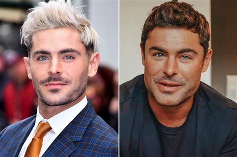 Zac Efron Plastic Surgery Video: Before & After Photos In 2022 - Has He ...