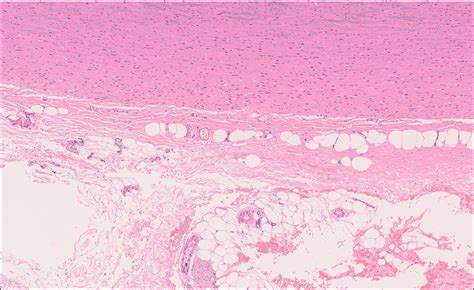 Blood vessels – Normal Histology – NUS Pathweb :: NUS Pathweb