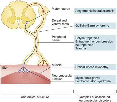 Neuromuscular Disease in the Neurointensive Care Unit - Anesthesiology Clinics