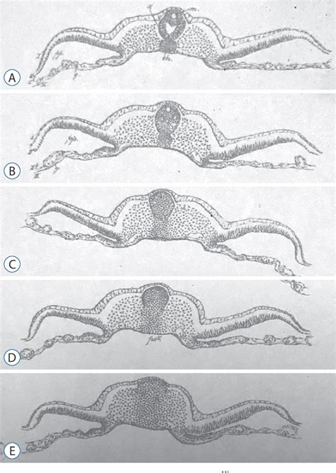 Figure 1 from Overview of Secondary Neurulation | Semantic Scholar