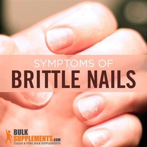 Brittle Nails Symptoms, Causes and Treatment