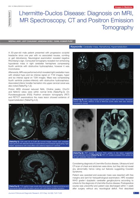 (PDF) Lhermitte-Duclos Disease: Diagnosis on MRI, MR Spectroscopy, CT ...