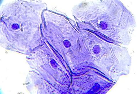 Cheek Cell Under Microscope