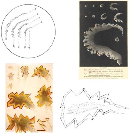 Exploring the visual hallucinations of migraine aura: the tacit contribution of illustration ...