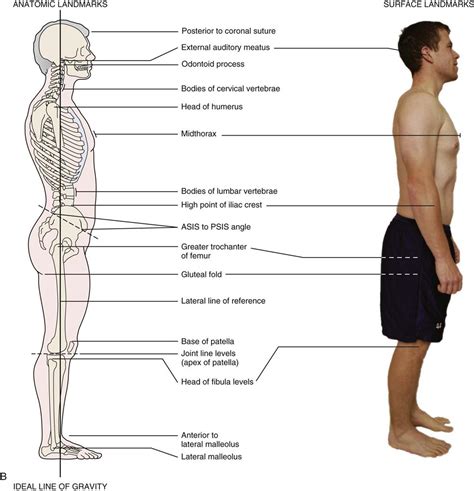 Assessment of Posture | Musculoskeletal Key