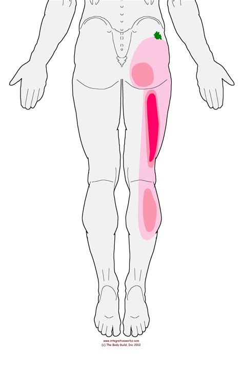 Triger points - The Seizing Hamstring | Integrative Works