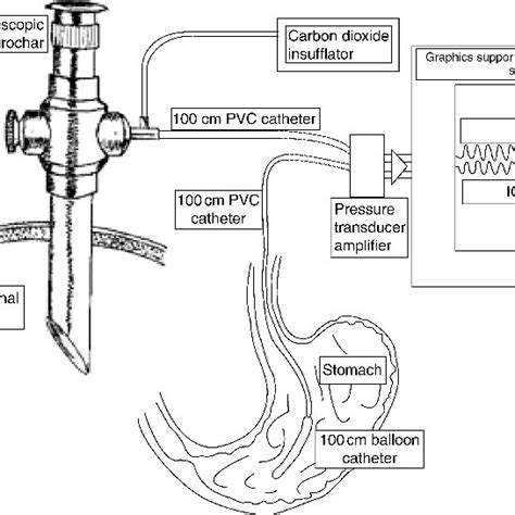 (PDF) Intra-abdominal pressure measurement: Validation of intragastric pressure as a measure of ...