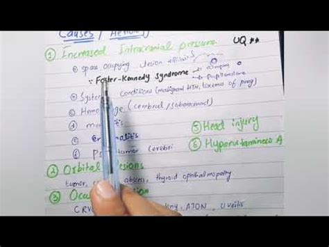 Papilloedema | Causes | Optic nerve head... Part. 2 - YouTube